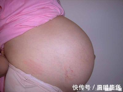 蒋女士|剖腹产宝宝和顺产宝宝有区别,并不是智力的高低,而是这三点