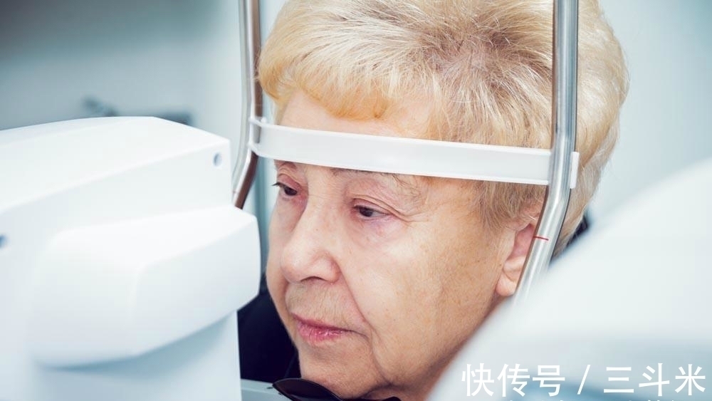 双眼皮 手术割了双眼皮的人,老了后会变成什么样?现在知道还不晚!