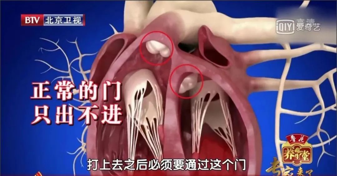 瓣膜|高血压“突然正常”,别急着高兴!很有可能是这种致命危机