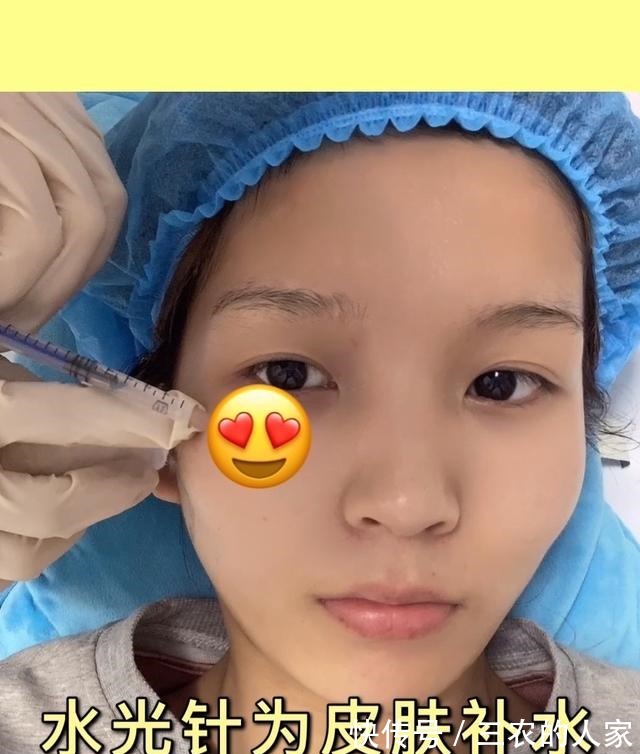 光子 缩毛孔水光针光子嫩肤双管齐下!缩毛孔水光针光子嫩肤双管齐下!