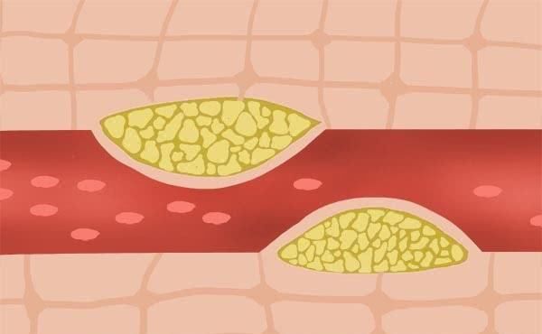 一天只要走多少步,就能护血管认准这个范围,坚持走就行