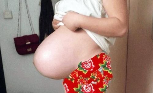 孕肚|孕妈什么时候“显怀”才正常?过早显怀,可能和这些原因有关系