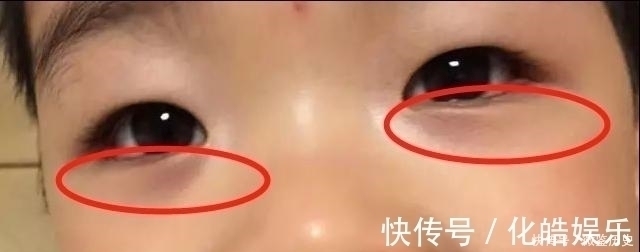 千金方|食疗“消食冠军”,效果是山楂的8倍,消积食健脾胃,孩子可常喝