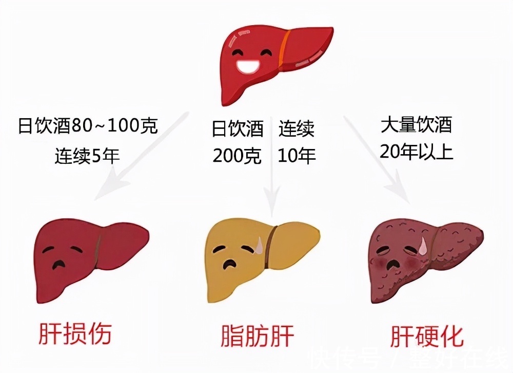 丁型肝炎|肝炎危害大,该如何进行预防?医生建议:做好这5点或能预防肝癌