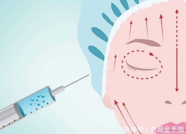 脸上打“玻尿酸”的女孩子之后怎样了?听美容专家一说全明白