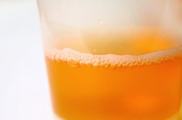 起有|晨起有4种“异常”,或是肝病前兆,全不占,值得祝贺