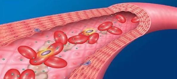 器官|体检血压14290,为啥什么感觉也没有,如何能知道身体受到了损伤
