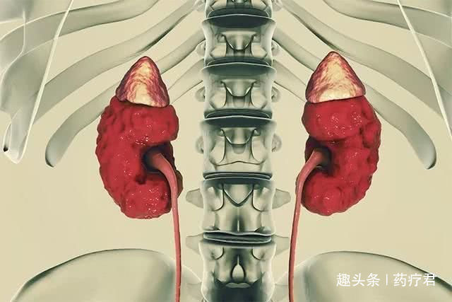 糖尿病并发症|糖尿病是如何把肾脏搞坏的预防糖尿病肾病,要守住4道防线