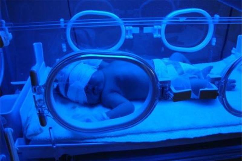 珊珊|黄疸新生儿刚出院又入院家长晒太阳退黄惹祸!医生治疗全身换血