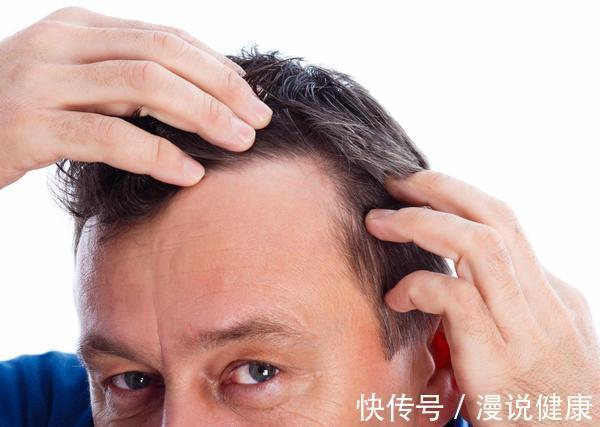 烫发|每天掉发超过100根才是脱发!脱发的5大元凶,劝你日常少碰为妙