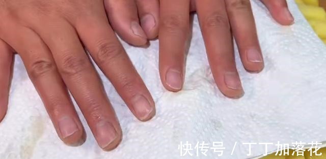 土豆别再炒着吃了,教你一个新做法,外酥里嫩,酸甜适口!