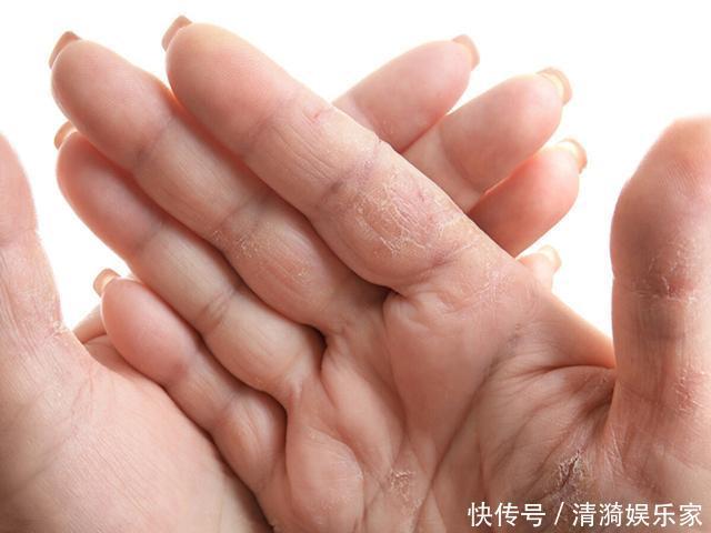 早晨是养肝“黄金期”,尽量做到这三点,助你有效“抵御”肝病