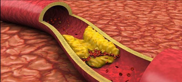 血管|107岁长寿老人,血管仅67岁且不堵,秘诀不是多运动,而是3件事
