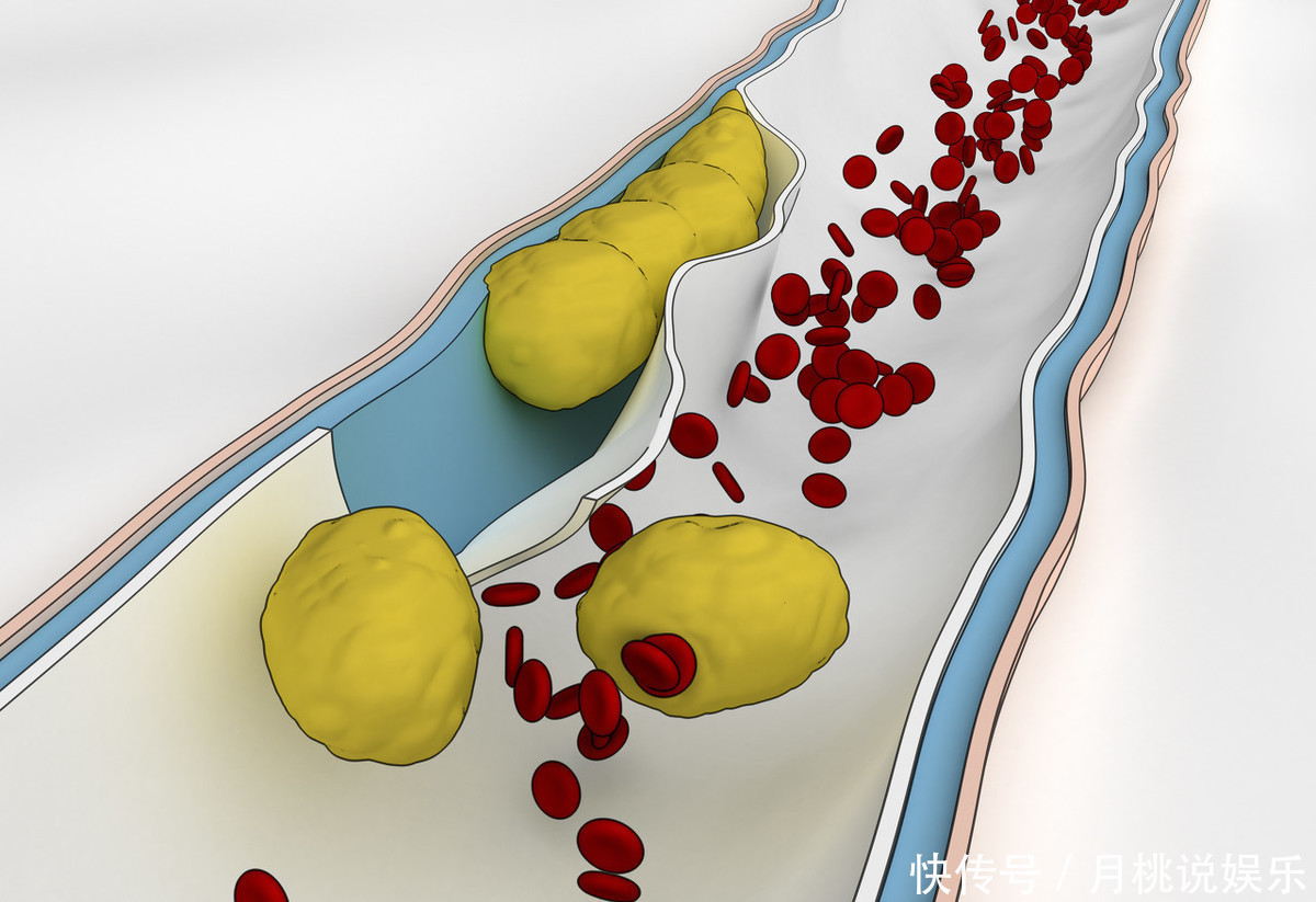 豆豉|脚上有个“化血栓开关”,打开它,就可清血管、防血栓
