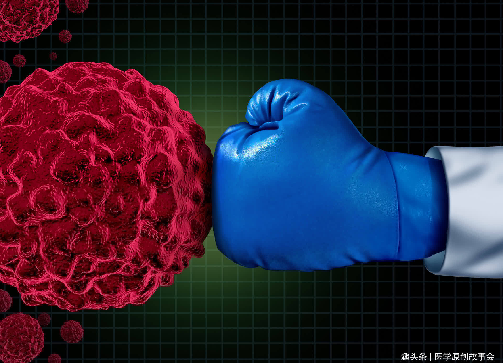 癌变|前列腺开始癌变,排尿会有三个信号,若你三个都有,提示该体检了