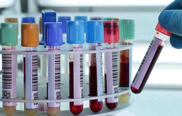 李女士|孩子智商高不高看他是什么血型,这两种血型搭配最聪明