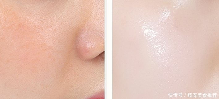 药店有二种“医用眼霜”,对付皱纹眼袋小菜一碟,遗憾是知道的人太少