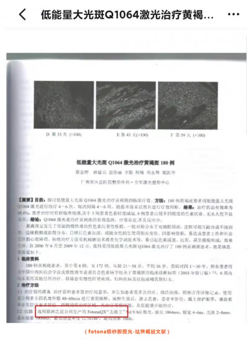 祛斑|涨知识：激光祛斑一定要「结痂」才有效？