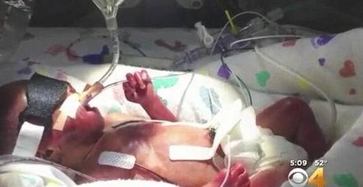 重症监护室|女子生完头胎仅9个月二胎出生,在此之前竟不知道又怀孕了