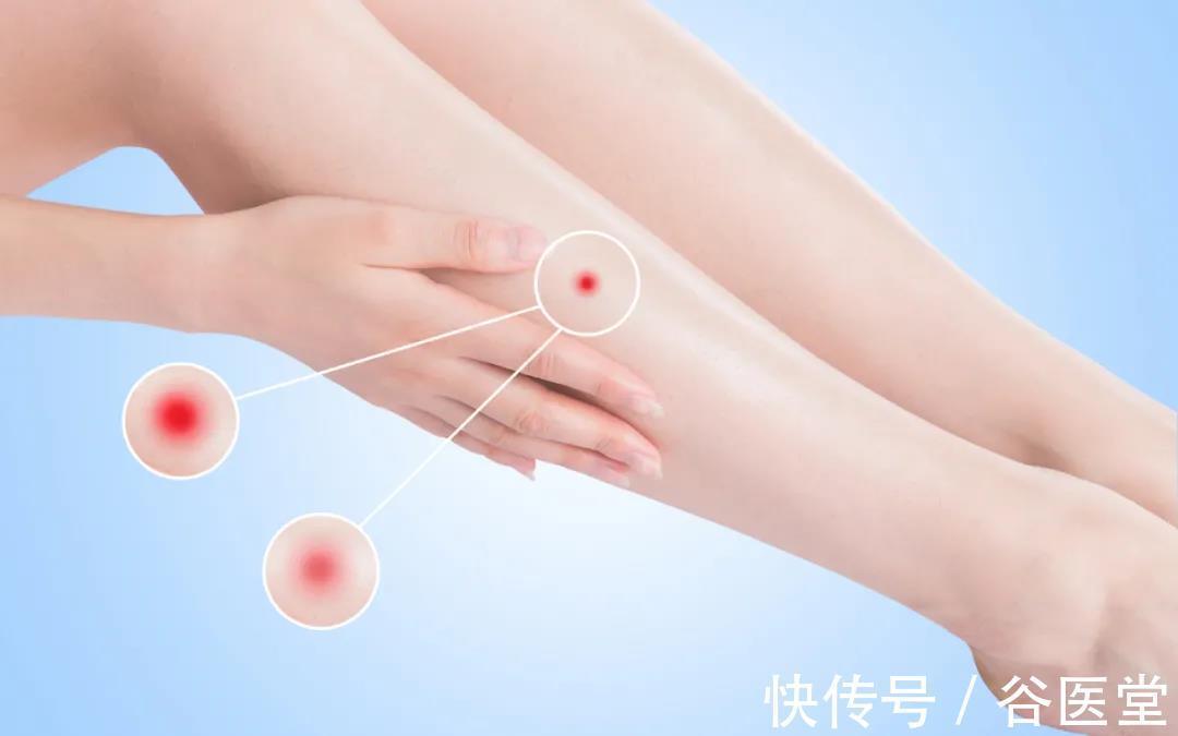 疑难病|夏季皮肤病高发？湖南省名中医曾洪伟运用中医整体疗法，为患者解除困扰！