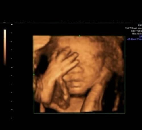 产妇|产妇产检做“四维”,胎儿在子宫里“数数”医生:下一个数学天才