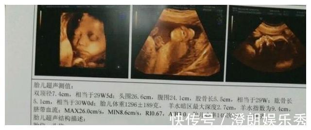 股骨长|孕检时,若怀的是男宝宝,多数会有这3种孕检结果,你都符合吗?