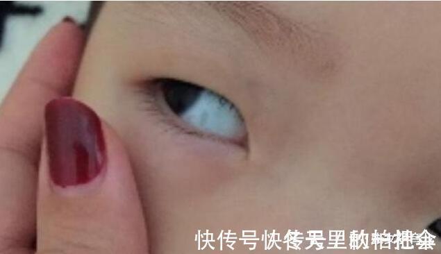 张女子|3岁宝宝眼白出现黑点，怎么回事儿听了医生的答案，终于放心了