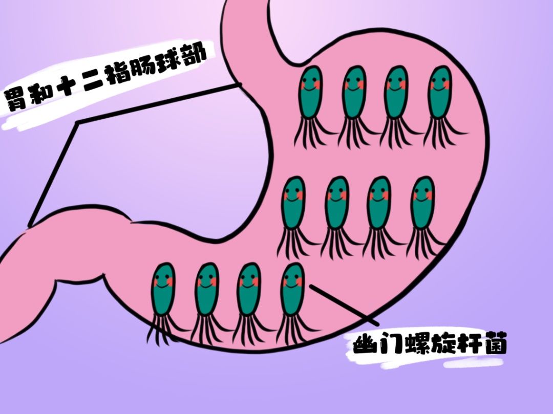 hp|人体使用说明：不怕胃酸，喜欢“定居”胃里的幽门螺旋杆菌