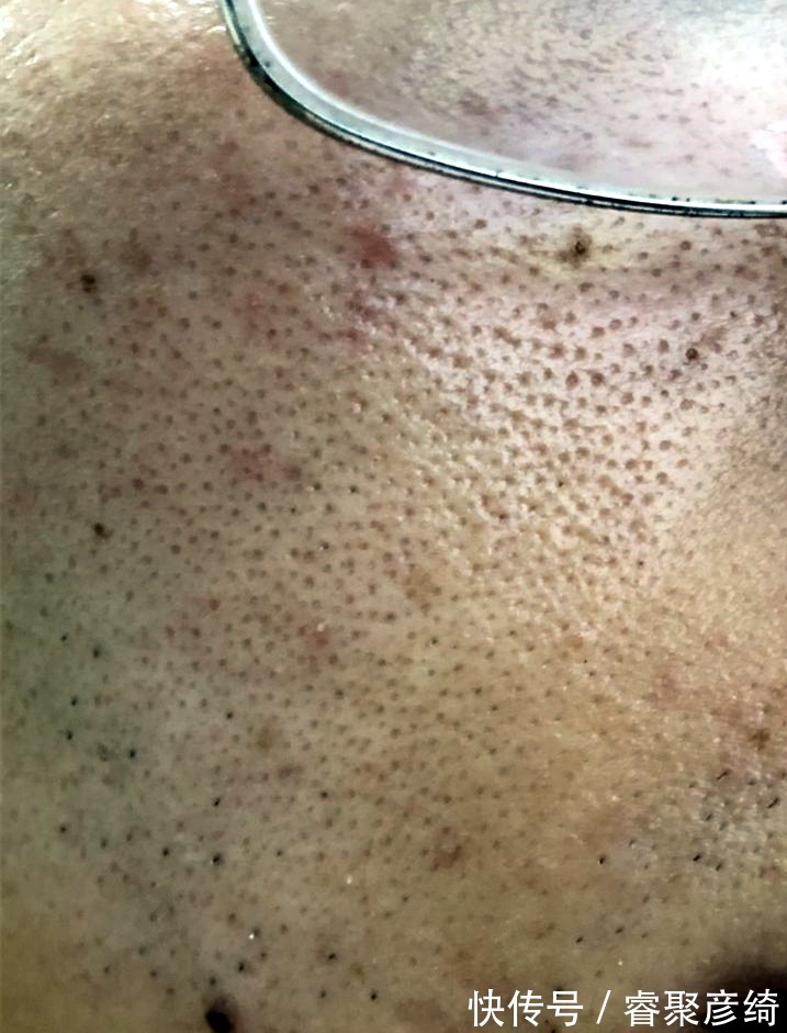 洗脸|为什么我的爽肤水不好用?