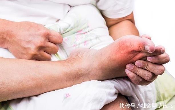 不升|患痛风的人,尽量多吃两道菜,少碰三种水果,可以使尿酸不升而降