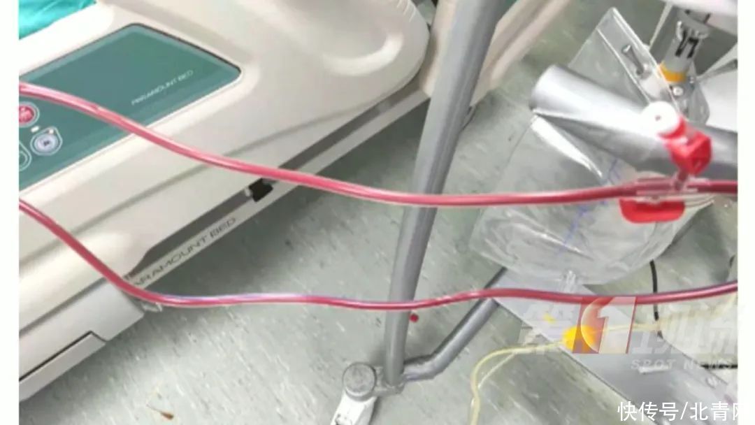 急性胰腺炎|男子血液竟变乳白色！医生：这么吃要当心