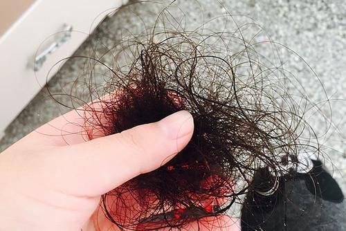 男性|男性进入衰老期,外表会有哪些体现?了解一下