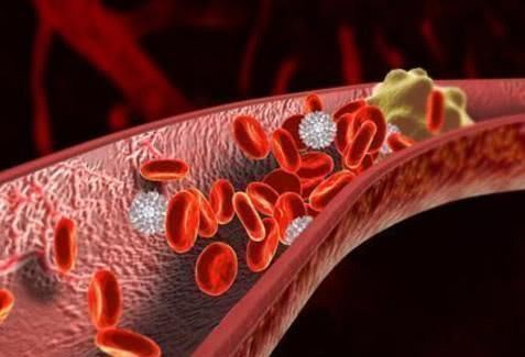 抗氧化物|血液粘稠的人，一定要吃这几种食物，助你清理血管，远离血栓