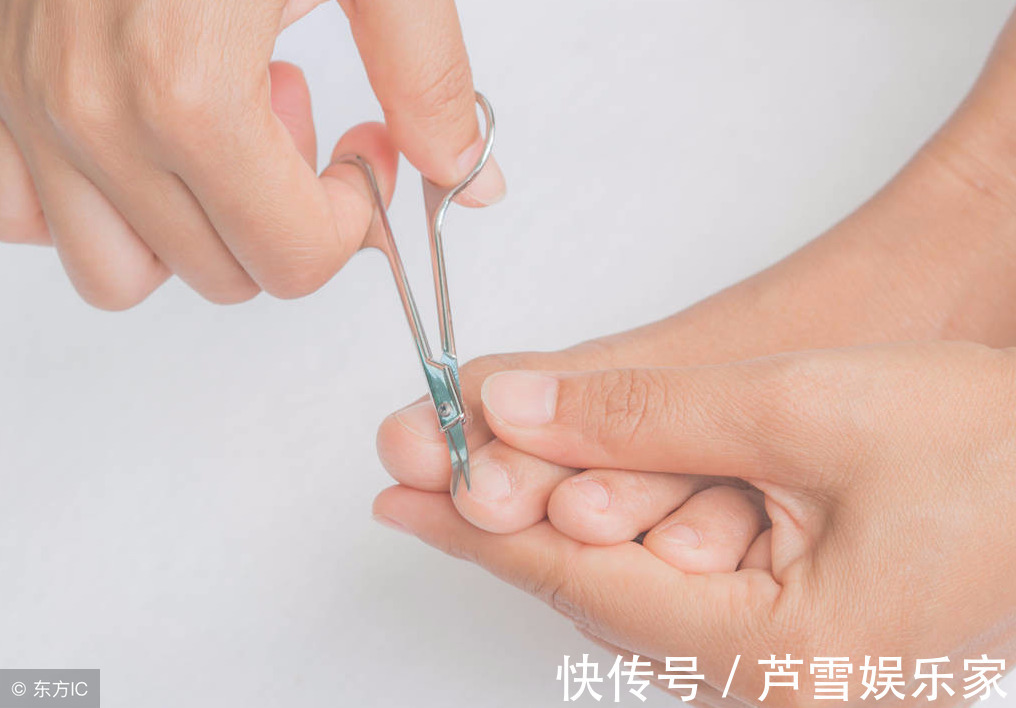 甲周|16岁少女6年没剪过趾甲，这酸爽，简直不忍直视，青少年应注意