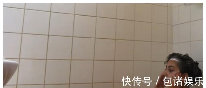 过敏|英国23岁女孩患“水过敏”,洗澡堪比酷刑,全球患者不超过100人