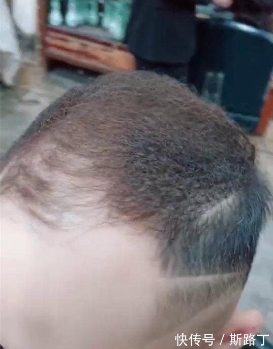 男子|奇闻:男子用黑色发卡烫发,卷起来头发更稀疏,怕剩下头发被扯掉