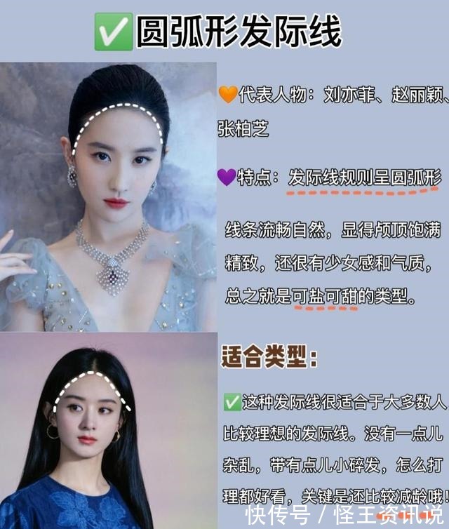 发际线 几种常见的发际线,你又是哪一种呢几分钟教你植发如何选发际线!