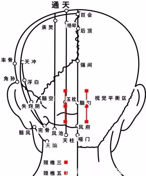 古法|【真实案例】长期便秘太痛苦？不妨试试这个古法！