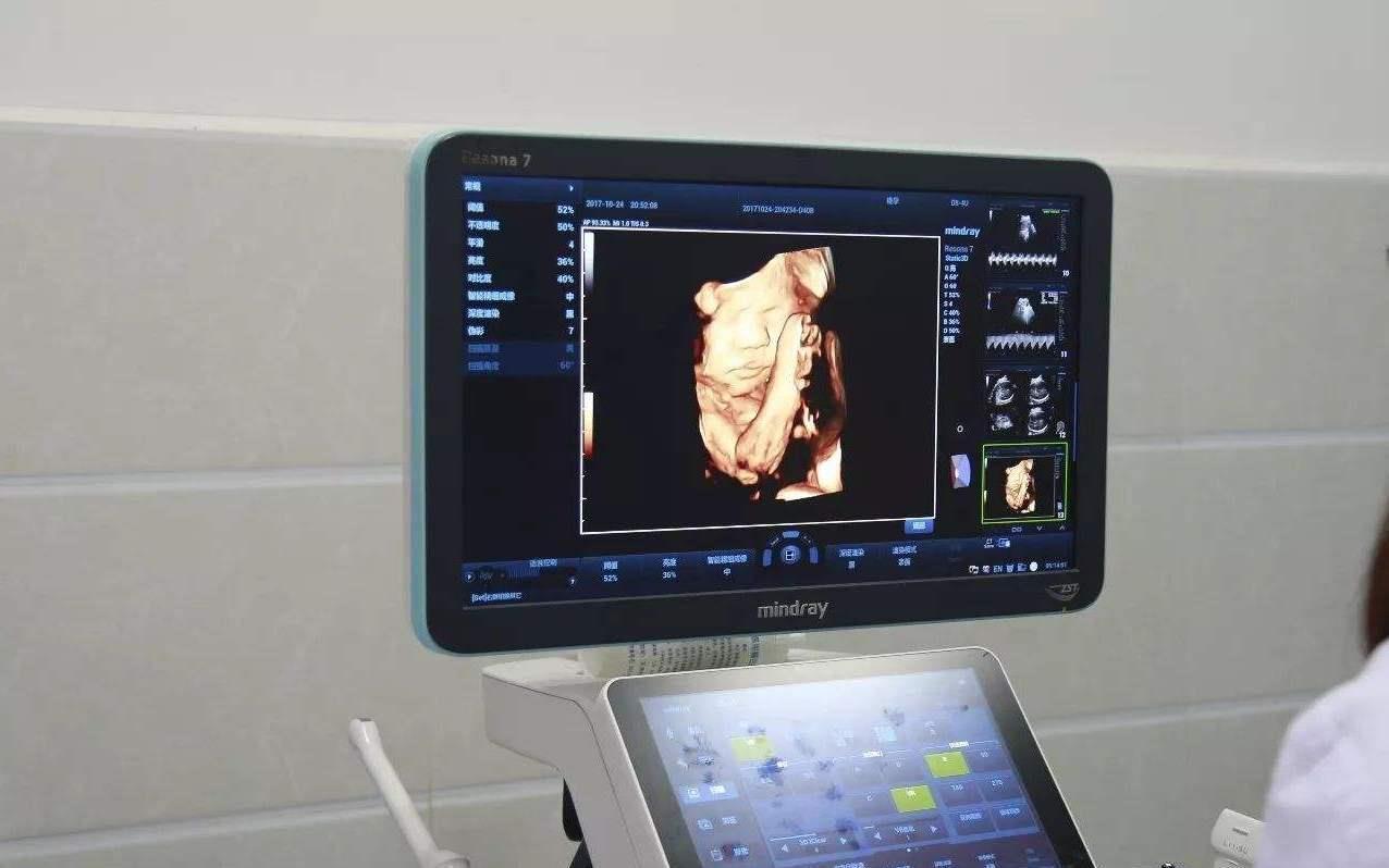 好孕|怀“小王子”的宝妈,身上有这4大特征,赶快接好孕吧