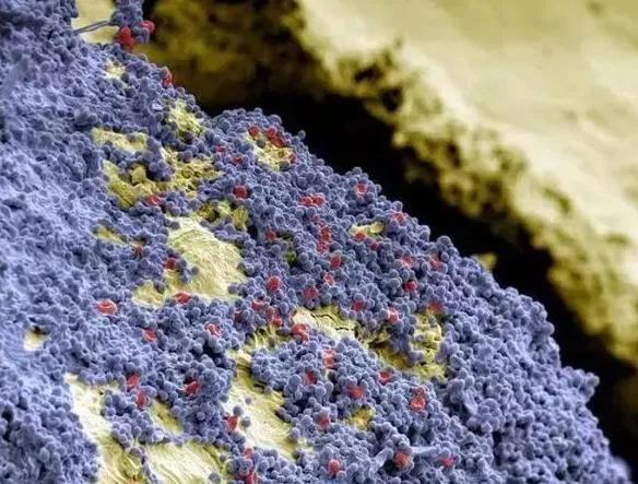 恒牙|4岁男孩牙齿几乎全黑6岁前,不要让孩子自己刷牙!