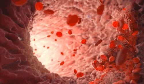 荞麦|甘油三酯超标常见2种植物煮水喝,降甘油三酯,无高血脂