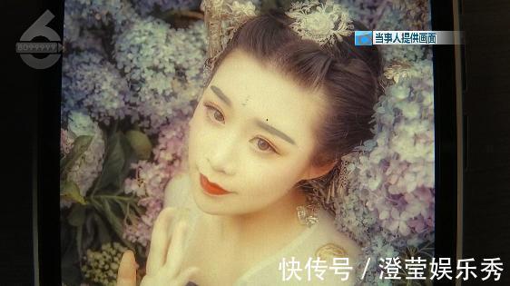 右眼|比原来丑这么多！女子花钱整成“阿凡达”眼睛都闭不上：“昨晚又是一夜没睡”