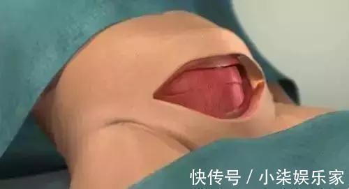 导尿管|剖腹产最痛是什么时候过来人的说法给你一些参考,孕妇早知道好