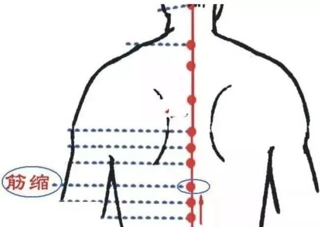  牢记全身疾病特效穴，专穴专用！