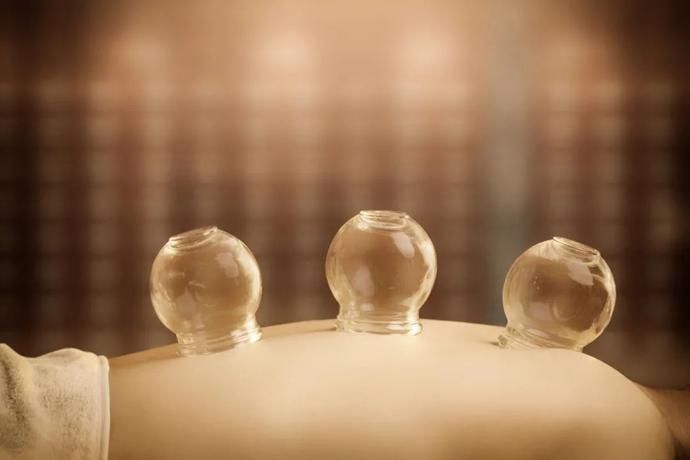 火罐|拔罐可以治什么病？这些误区要避开