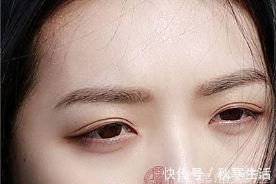 眼睛|眼疲劳怎么办有眼疲劳的人要这样做