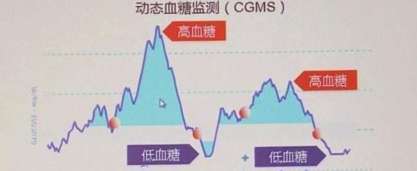 血糖|糖尿病患者，若身上出现2个现象，恭喜，血糖控制得还算不错！