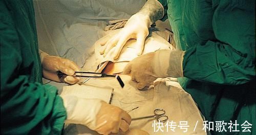 子宫|剖腹产只是“挨一刀”就完事?看完手术全过程,忍不住心疼女人