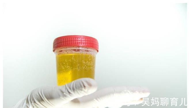 前兆|糖尿病肾病会有哪些前兆?列出来了,糖尿病人建议了解