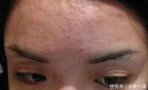 黑眼圈|子宫健不健康,照照镜子就知道,脸上没3个表现,子宫还算干净!